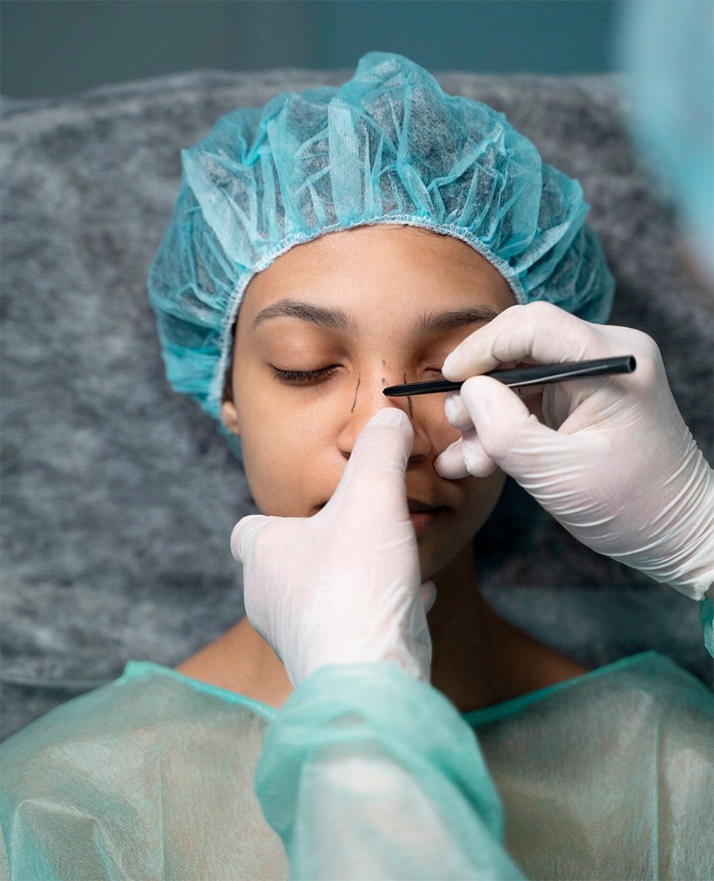 rhinoplastie-chirurgie-du-nez-suisse rhinoplastie-chirurgie-du-nez-suisse